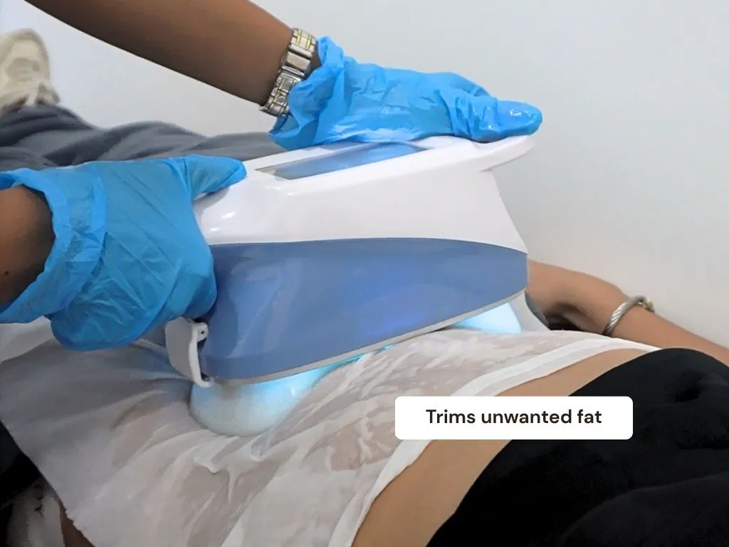 Cryotherapy