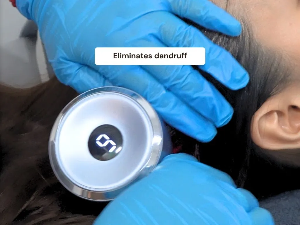 Dandruff Treatment