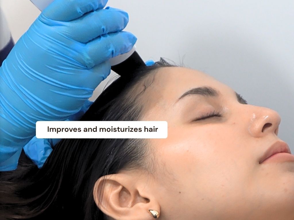 Dandruff Treatment result