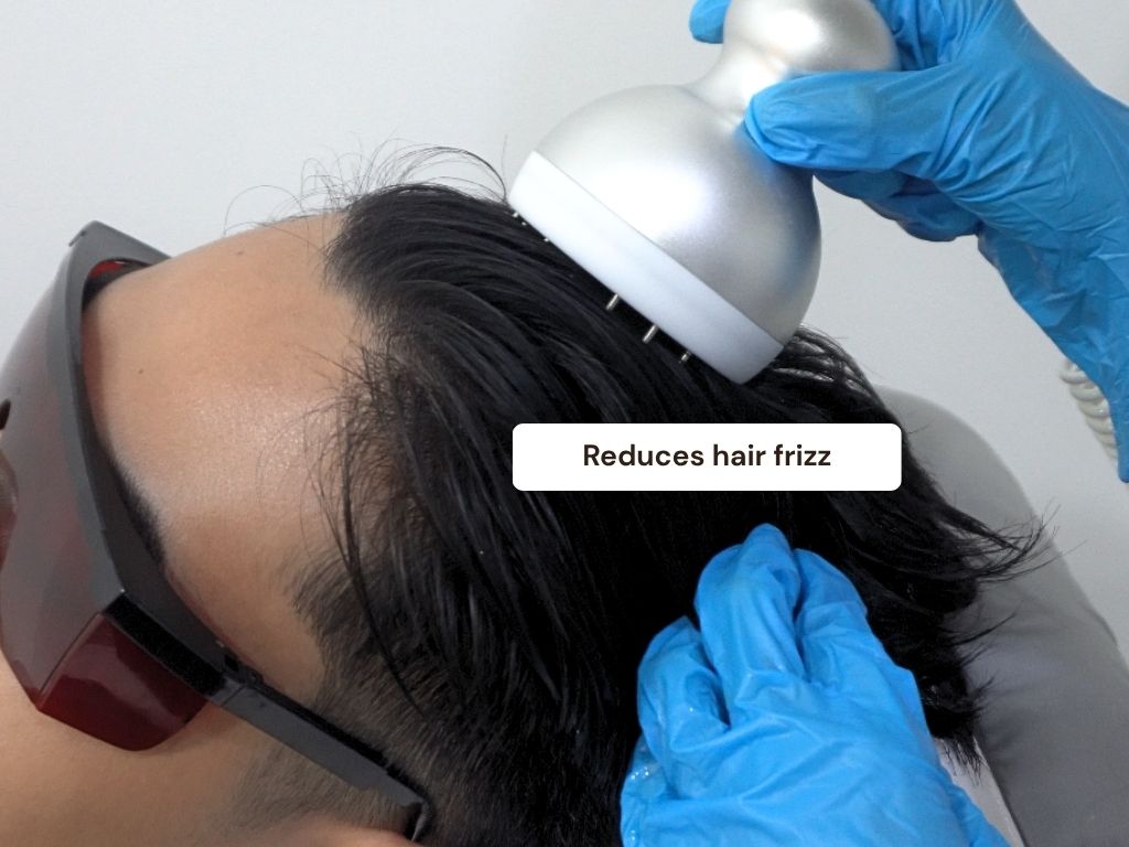 Hair Regrowth detail